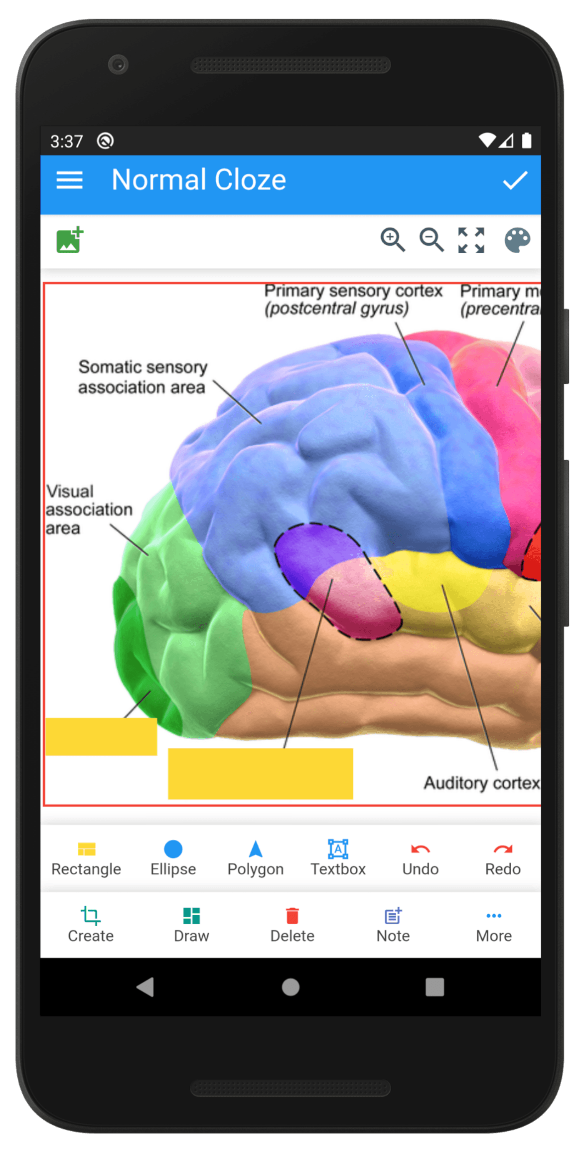 Скриншот 1 — Anki Image Occlusion