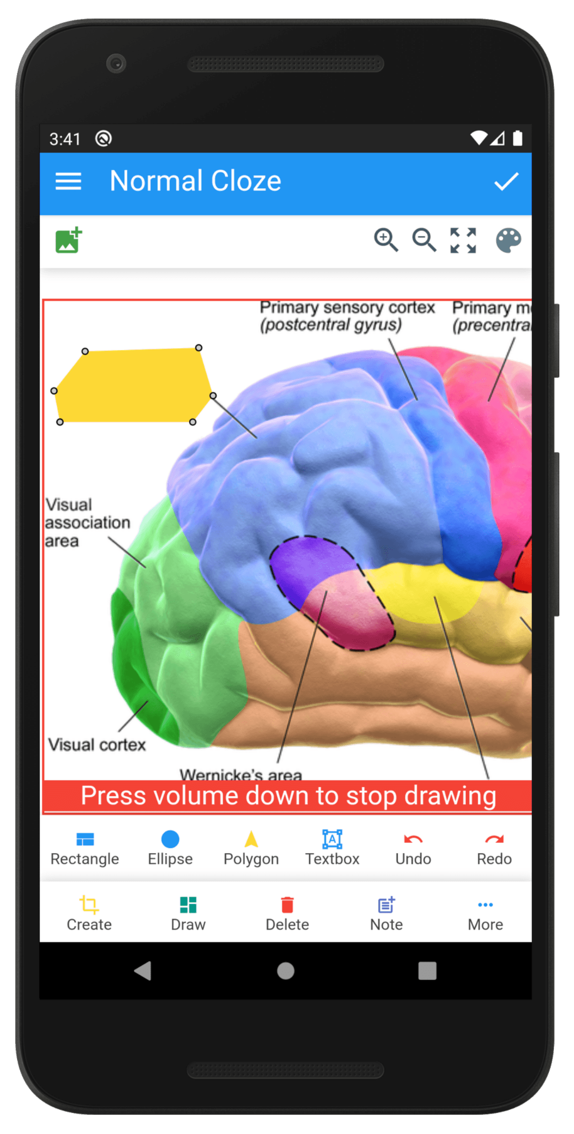 Скриншот 3 — Anki Image Occlusion