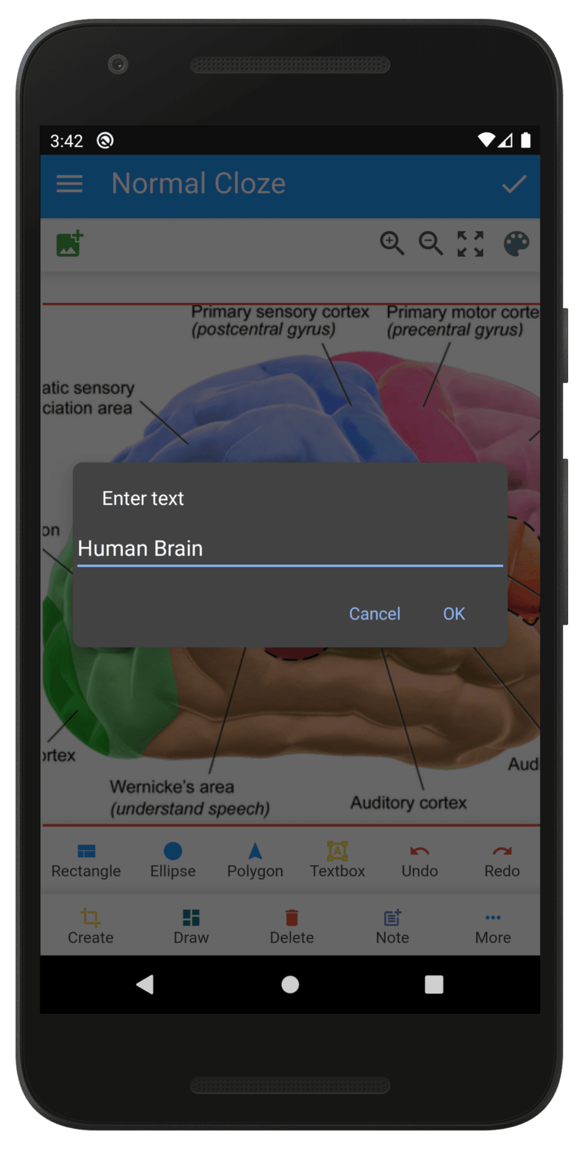Скриншот 4 — Anki Image Occlusion